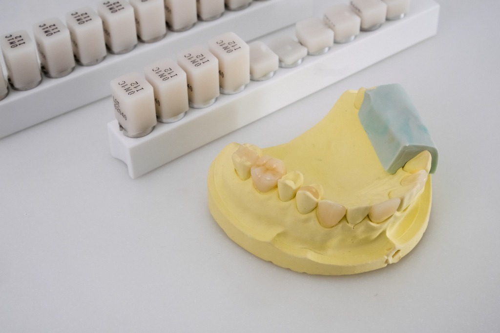 植牙的價格上萬元，推薦哪些保險能申請手術理賠？
