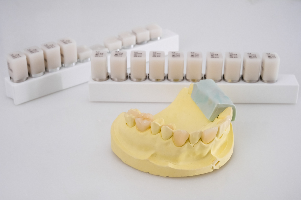 植牙介紹：牙醫師推薦解決牙齒缺牙較有益方式是植牙，為什麼？