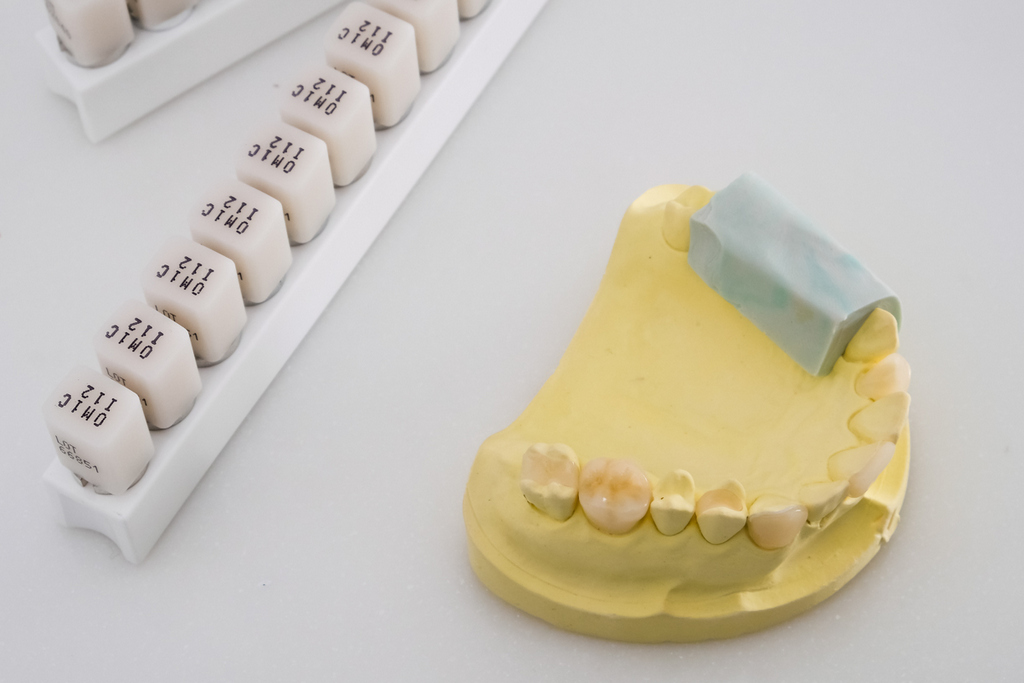 隱形矯正知識分享：原來牙套類型也有不同的區別！？