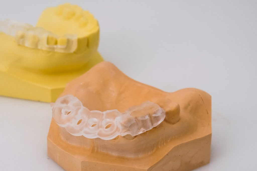 【全瓷牙冠】牙醫師會推薦哪些牙齒狀況要做全瓷冠？
