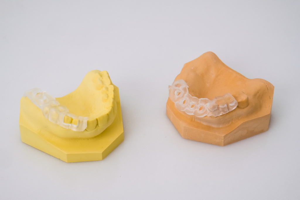 全瓷牙冠關係到自己的牙齒健康以及笑容美觀，這4件事值得在訂做時留意！
