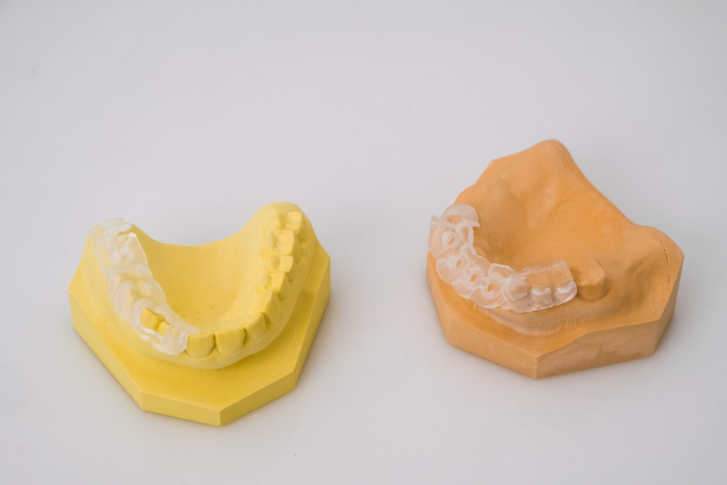 隱形矯正原來還有分！傳統透明矯正牙套vs.自鎖式透明矯正牙套